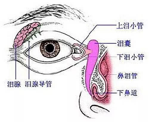 鼻泪管阻塞常可引起泪囊继发感染,形成慢性泪囊炎
